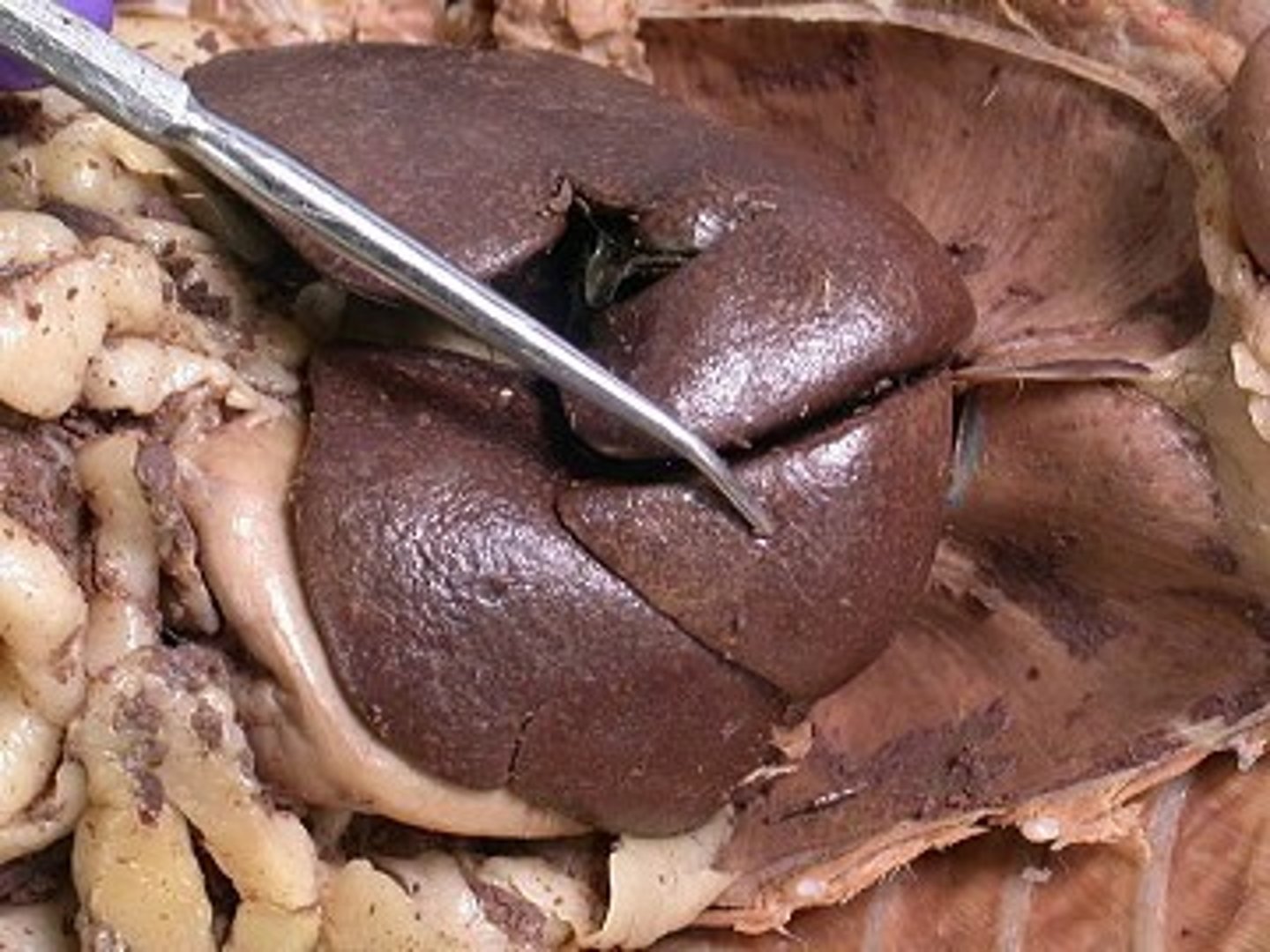 <p>Processes nutrients and detoxifies substances.</p>