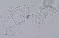 <p>Abnormal crystals: Cholesterol</p>