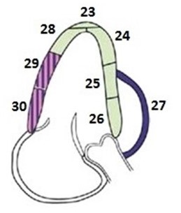<p>Name the wall segments for 3C</p>