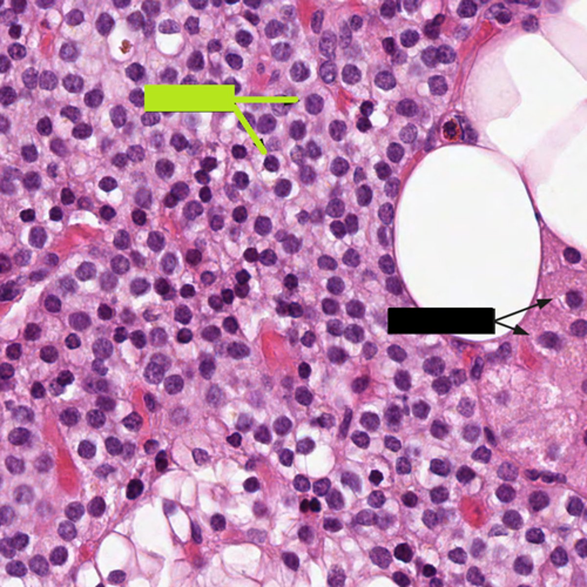 <p>What type of cell is the green box pointing to?</p>