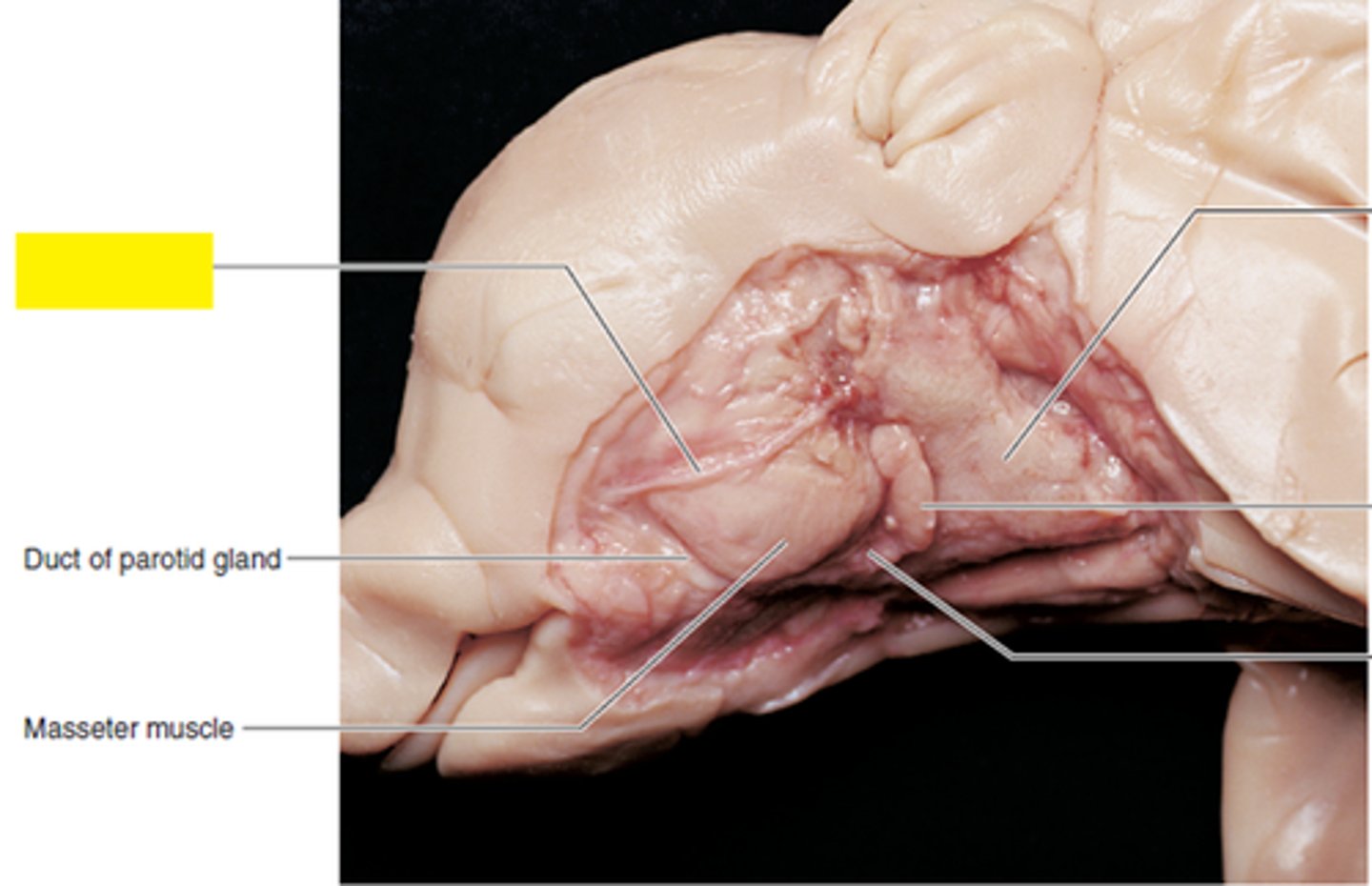 <p>Facial nerve</p>