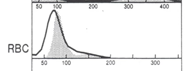 <p>the black line is the patient. the gray area is normal. what type of anemia is present?</p>