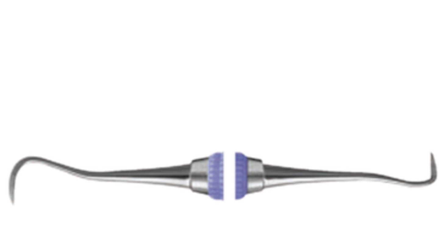 <p>Scaling anterior teeth supragingival</p>