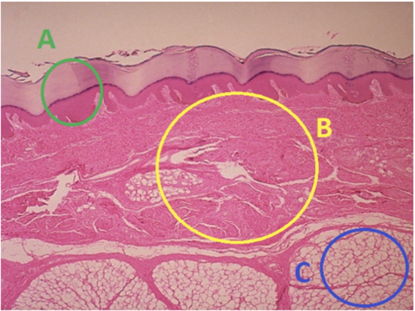 <p>Answer the following questions based on the features indicated in the following image. Which letter indicates the administration site for subcutaneous injections?</p>