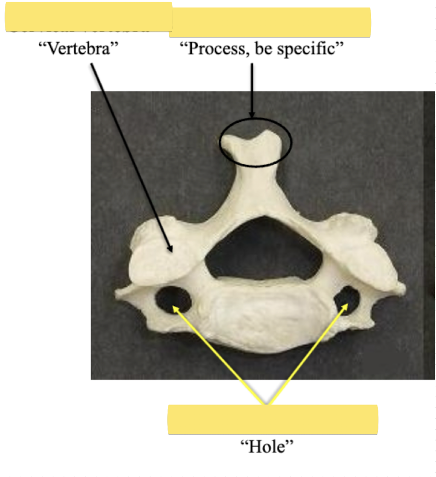 <p>Identify this <strong>vertebrae</strong></p>