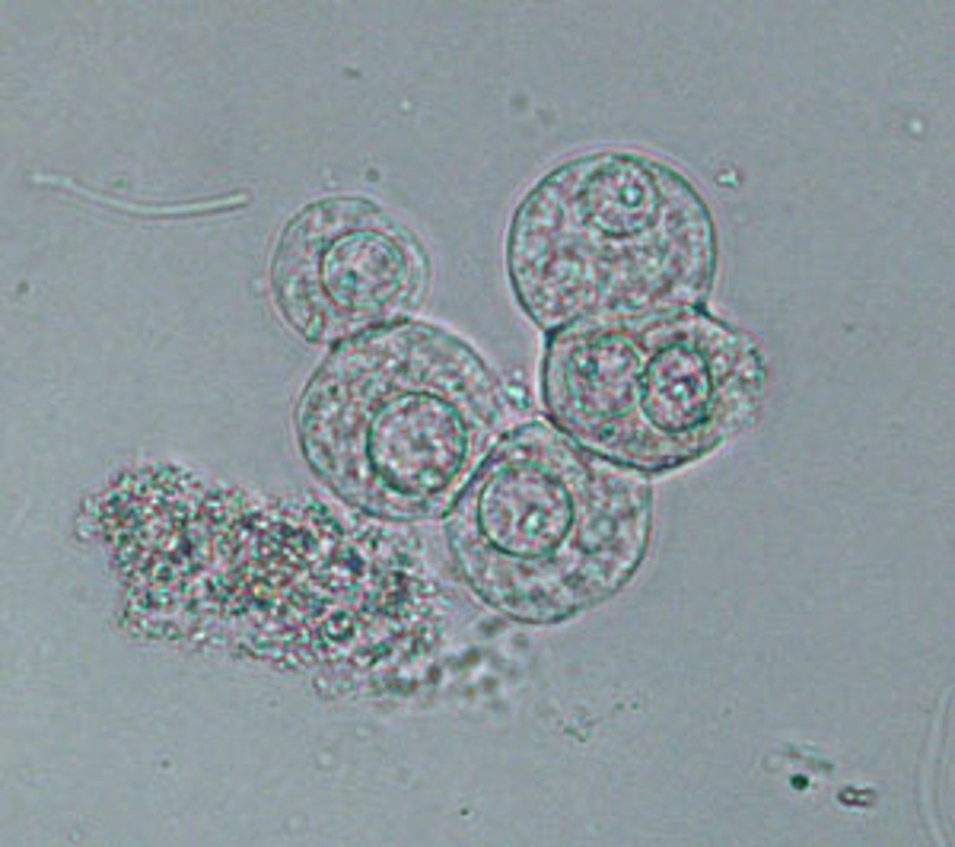 <p>- nucleus in the center</p><p>-round</p><p>-come from the bladder</p>