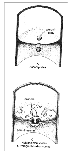 <p>Dolipore septa, septal pore caps or parenthosomes</p>