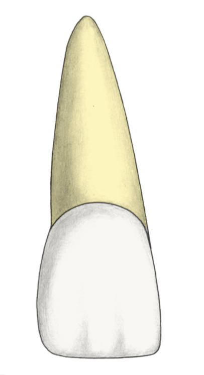 <p>Maxillary Central Incisor</p>