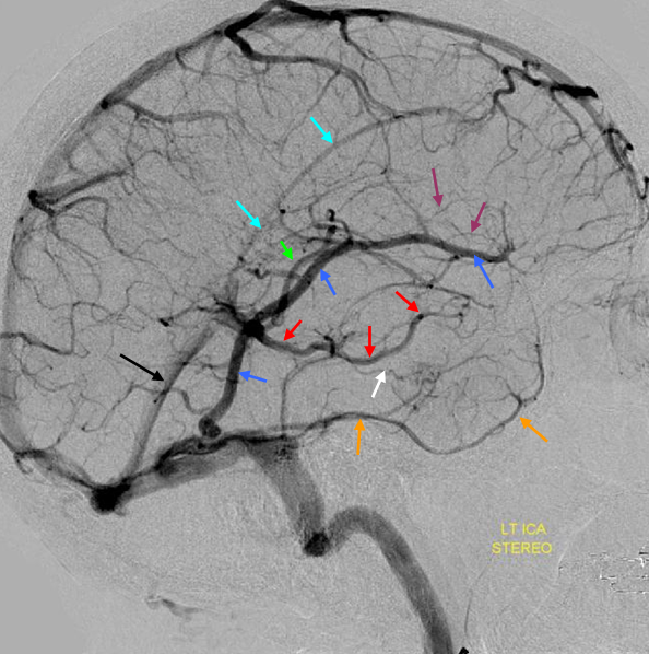 <p><strong>Venous sinuses</strong></p>