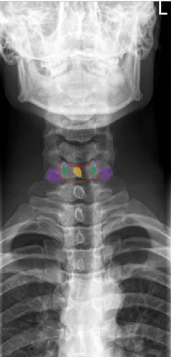 <p>Identify the green structure</p>