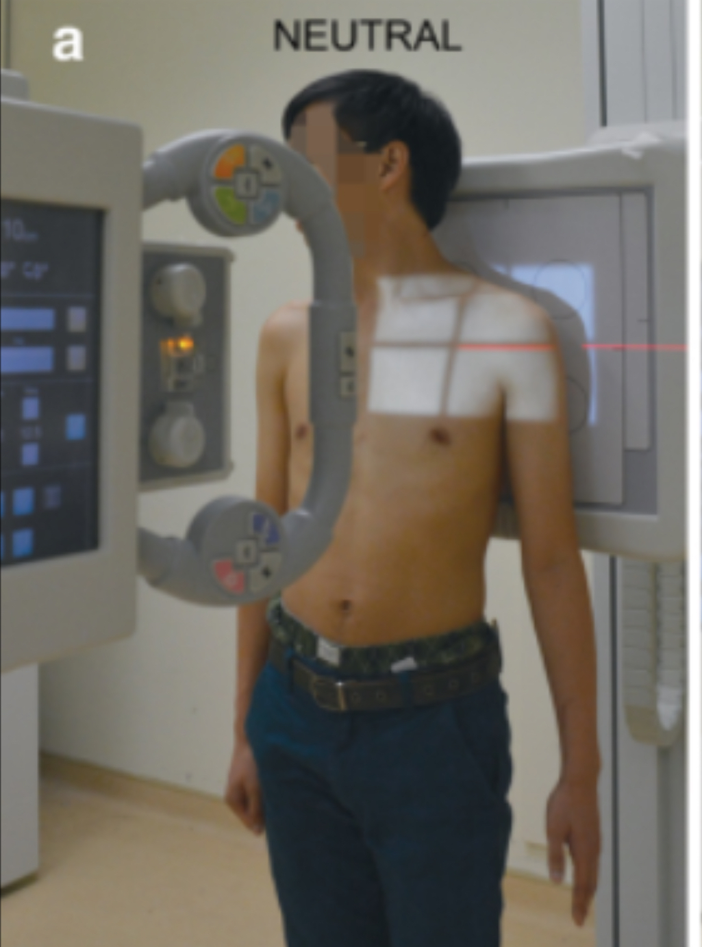 <p><strong>Shoulder (Trauma)</strong></p>