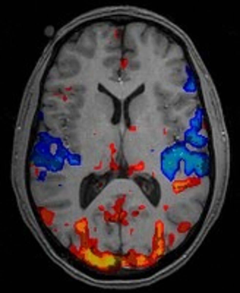 <p>a technique for revealing blood flow and, therefore, brain activity by comparing successive MRI scans, used to map pain centers.</p>