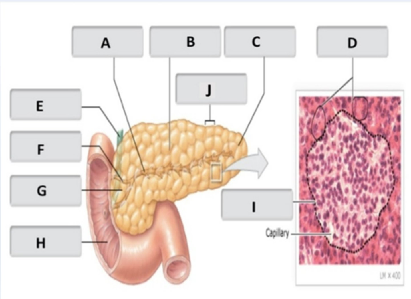 <p>body of pancreas</p>