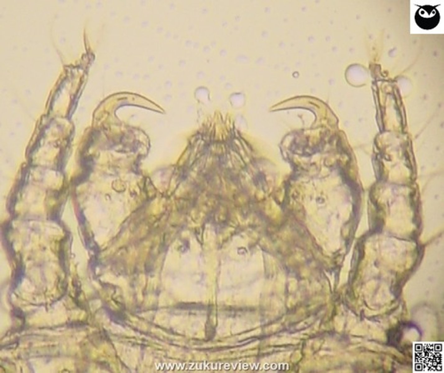 <p>A four-year-old male intact cat presents for pruritus and dorsal scaling. The organism shown under magnification below was found on the cat's fur.</p><p>What is it?</p><p>Otodectes</p><p>Notoedres</p><p>Cheyletiella</p><p>Neotrombicula</p><p>Sarcoptes</p>