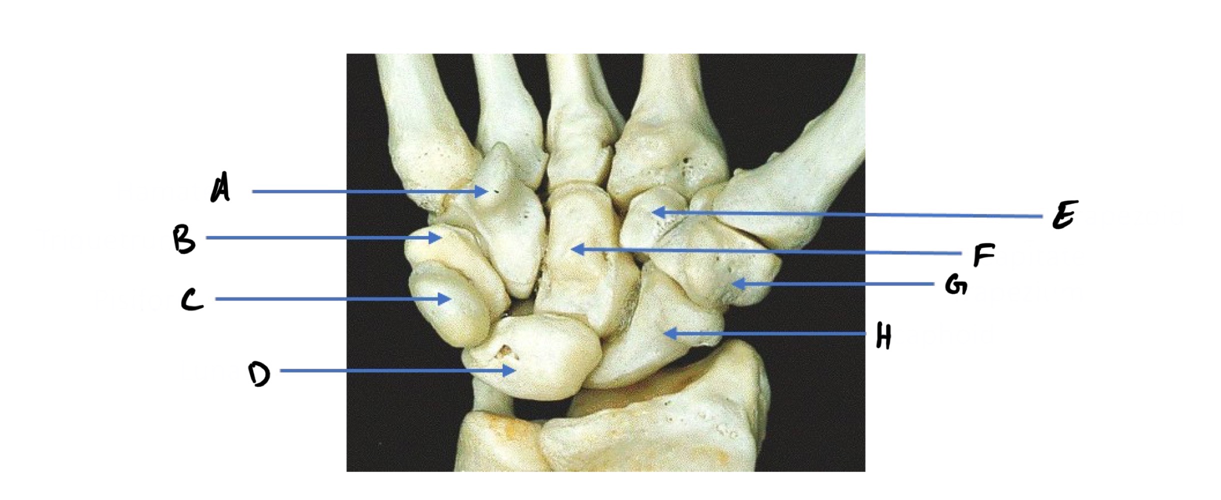 <p>A</p>