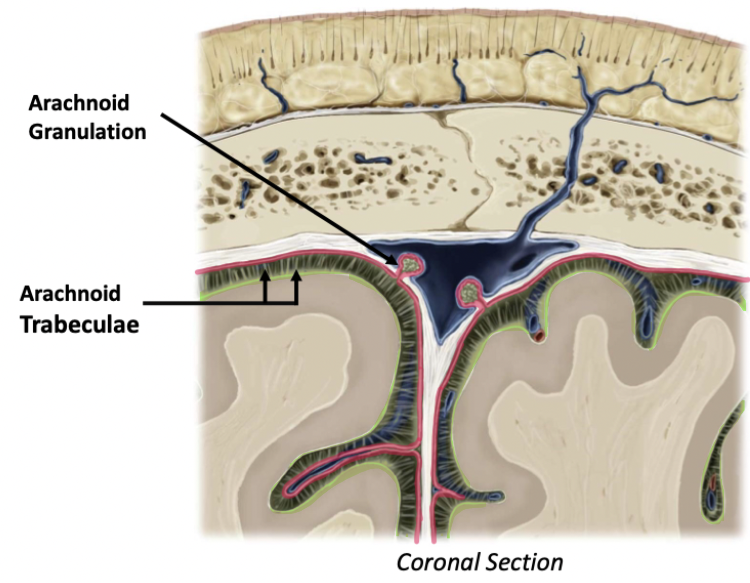 <ul><li><p>﻿﻿Sits deep to the dura</p></li><li><p><span style="color: green">﻿﻿Subarachnoid Space</span>, between arachnoid and pia, contains cerebrospinal fluid (CSF)</p><ul><li><p>REAL space</p></li></ul></li><li><p><u>Arachnoid granulations</u></p><ul><li><p>CSF exits the subarachnoid space through arachnoid granulations</p></li><li><p>These pierce through the dura to drain CSF into the dural venous sinuses</p></li></ul></li><li><p><u>Arachnoid trabeculae</u> support the arachnoid mater</p></li></ul>