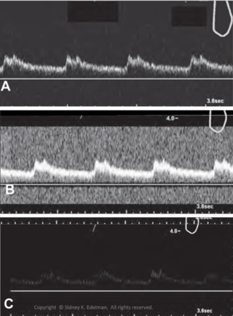 <p>waveforms</p>