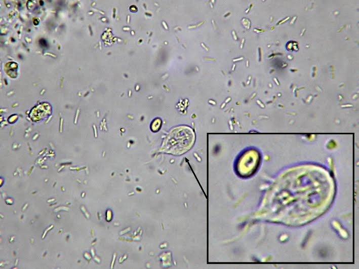 <p>What is this parasite?</p>