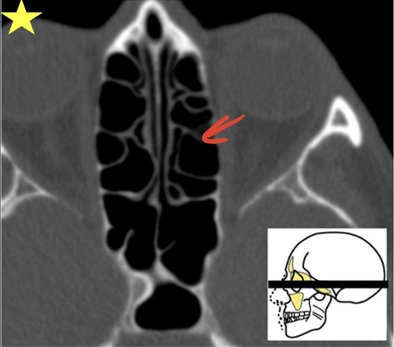 <p>Which structure is indicated by the arrow? What plane is this CT image in?</p>