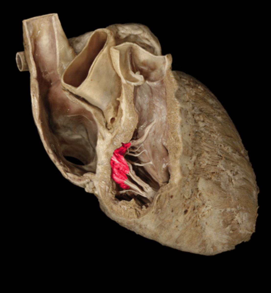 <p>AKA: right atrioventricular valve</p>