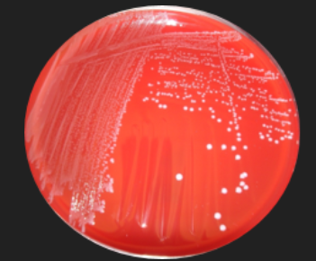 <p>Blood Agar: Streptococcus Identification — Which hemolysis results from teh production of streptolysin S or O?</p>