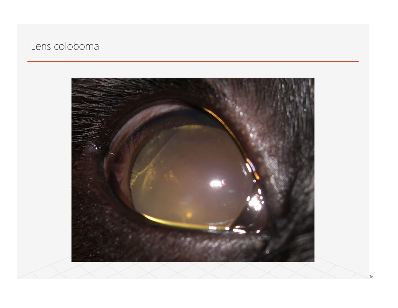 <p>appears to be due to lack of zonules in a specific location</p><ul><li><p>causes lack of growth of lens apposing affected area</p></li></ul><p></p>