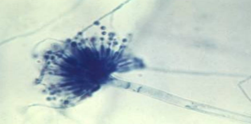 <p><em>Aspergillus</em> — </p><p>What is it’s spore structure name?<br></p>