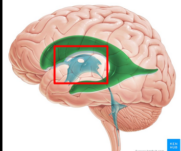 <p>where third ventricle lies in</p>