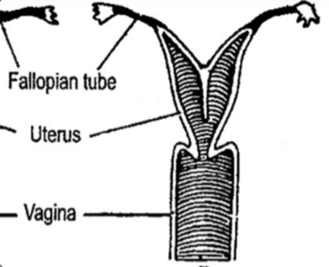 What type of uterus is this?