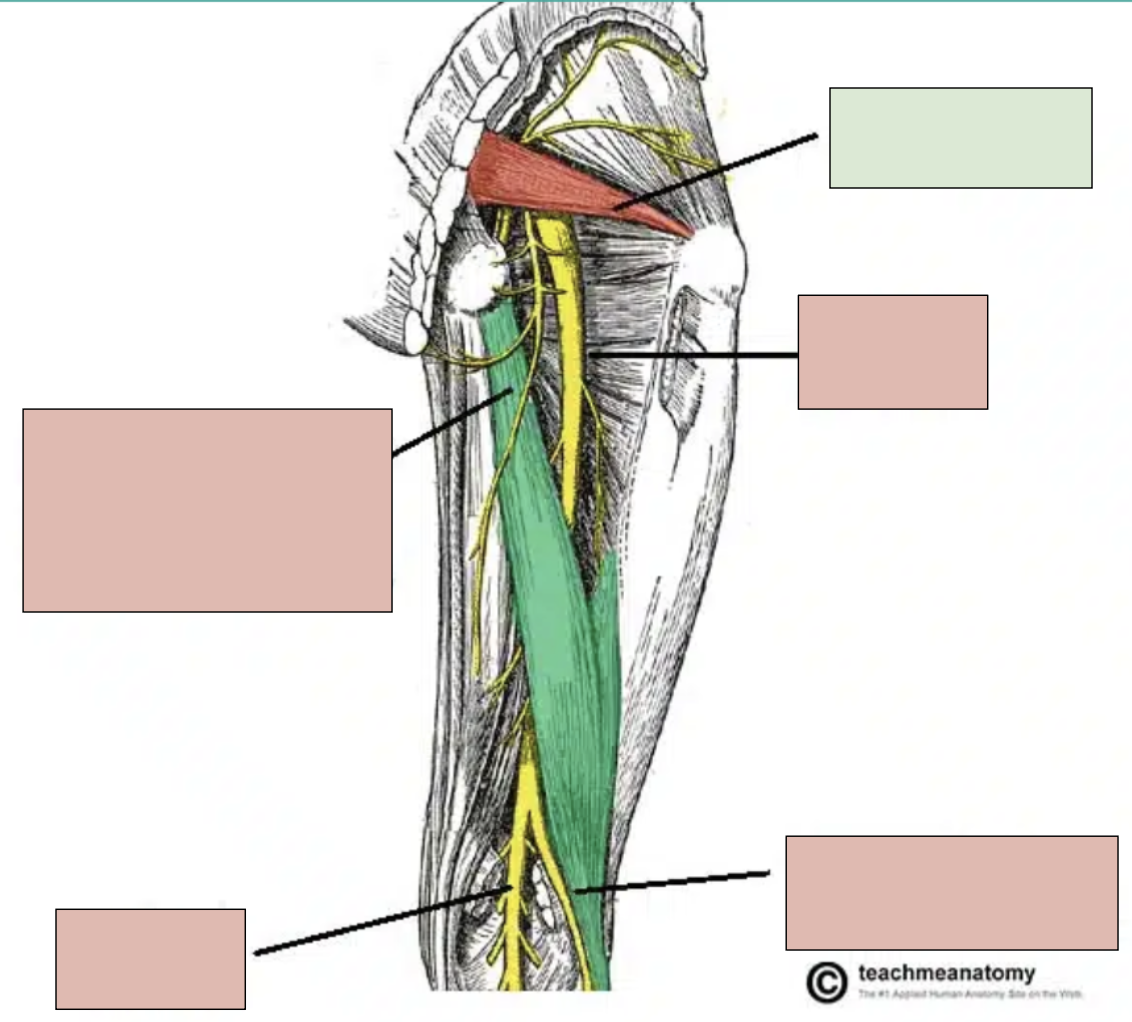 <p><span style="background-color: transparent;"><span>small deep muscle in gluteal region that can compress sciatic nerve</span></span></p>