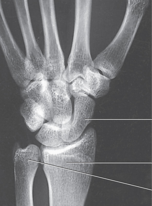 <p>What position is demonstrated?</p>