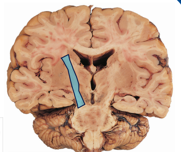 <p>What structure is highlighted blue? </p>