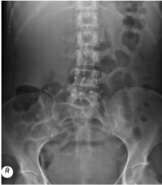 <p>What is this and what type of scan </p>