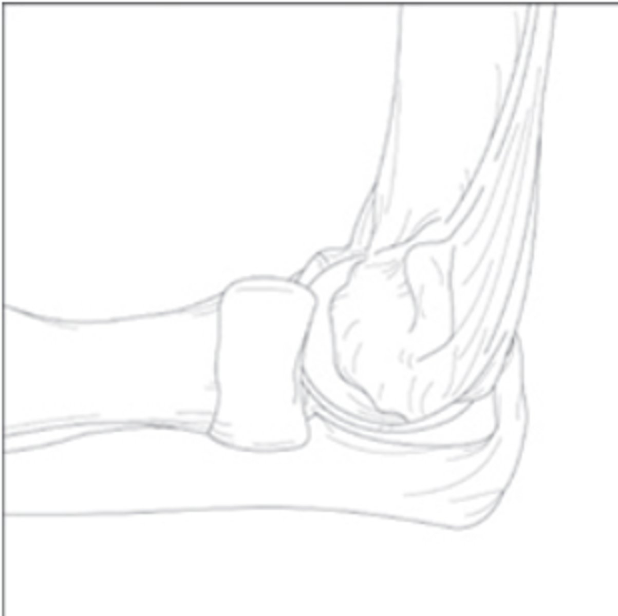 <p>What is the name of this joint based off of the shape of the articulating bones?</p>