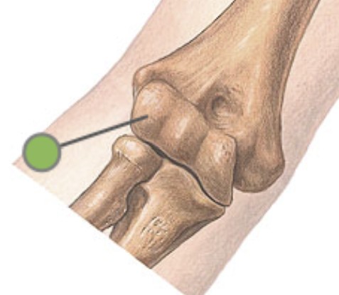 <p>Which bone landmark of the humerus is  smooth, rounded, and on the lateral side of elbow joint?</p>