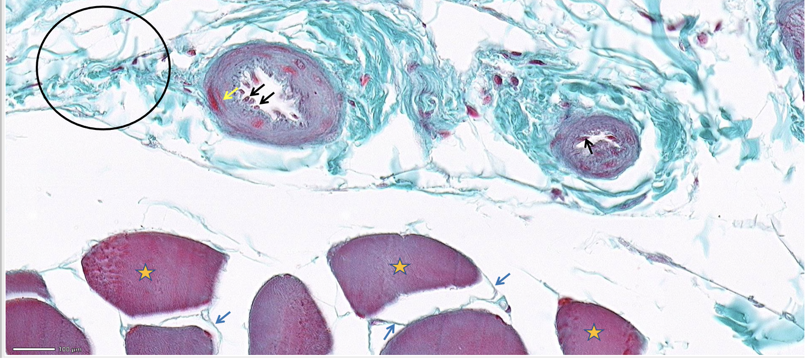 <ol><li><p>ID the cells at the tips of the black arrows</p></li><li><p>ID the cell at the tip of the yellow arrow AND what did Dr. Harp call these cells?</p></li><li><p>ID the layer and classify the tissue within the black circle.</p></li><li><p>ID the layer at the tip of the blue arrow.</p></li><li><p>ID the cells with the orange stars.</p></li></ol>