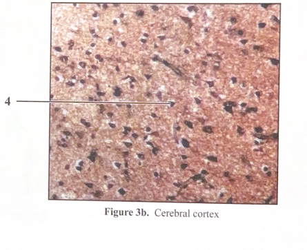<ol start="4"><li><p>Pyramidal cells&nbsp;</p></li></ol><p></p>