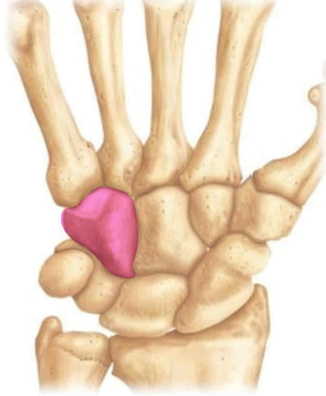 term image