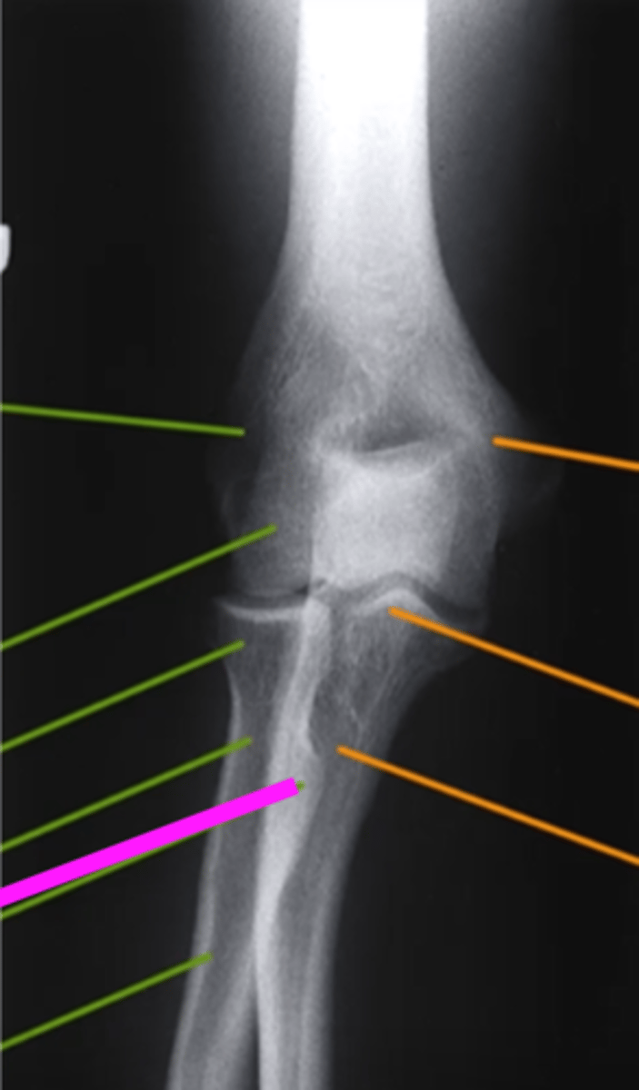 <p>what does the pink line point to?</p>