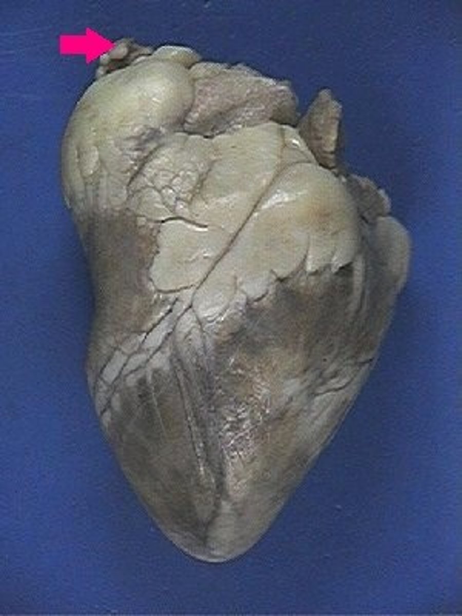 <p>Identify the chamber.</p>