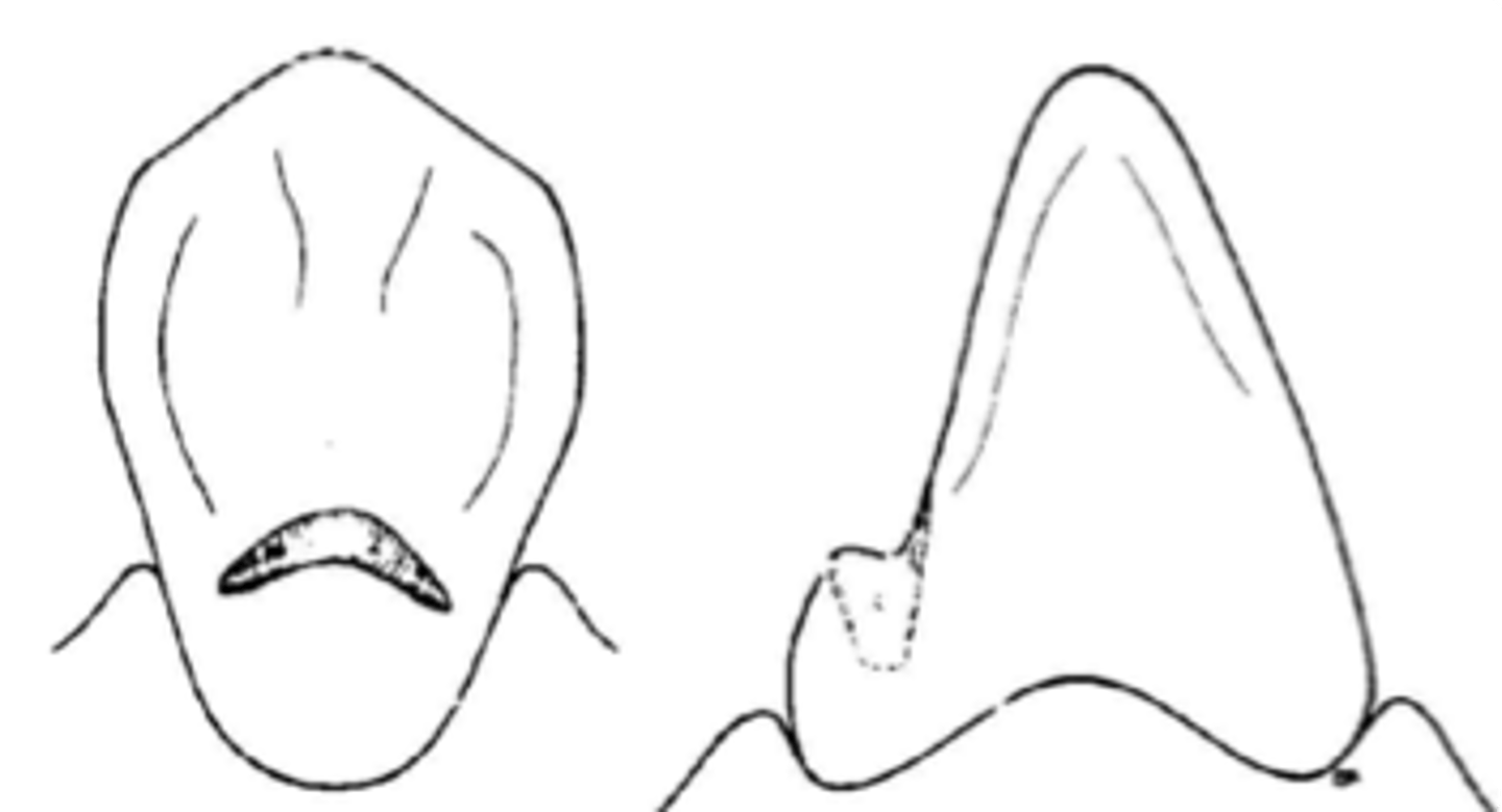 <p>Similar to occlusal rests, the rest must be made at the correct angulation in reference to the tooth surface to prevent the rest from sliding away from the tooth.</p>