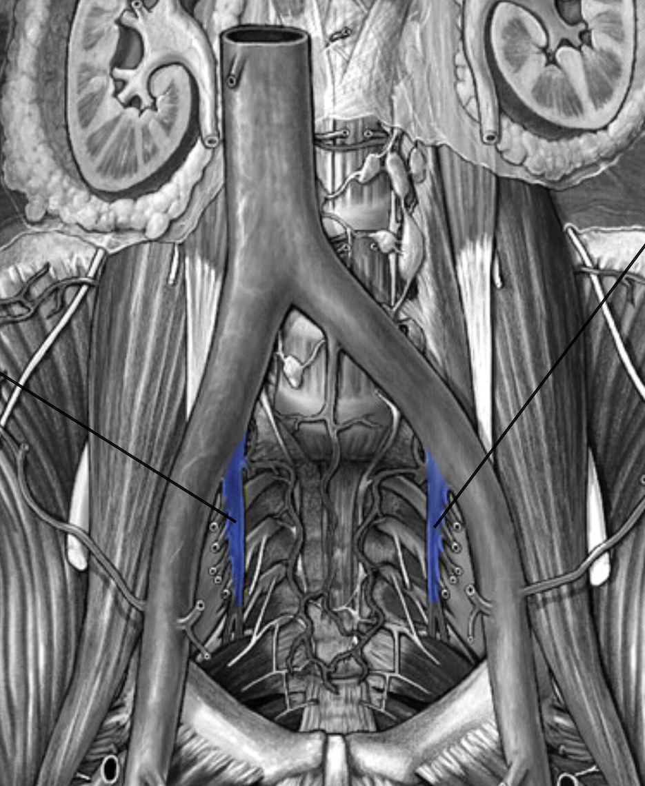 <p>Which veins:</p><ul><li><p>Inferior to common iliac vein</p></li><li><p>Medial to external iliac vein</p></li></ul><p></p>