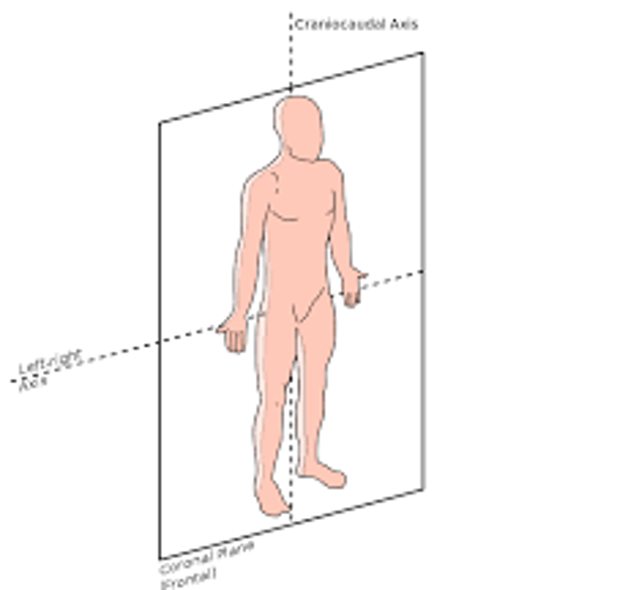 <p>any vertically oriented plane perpendicular to the median plane which divides the body into anterior (front) and posterior (back) portions. Frontal plane is a former name for this plane</p>