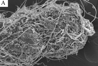 <p>is this endotrophic or ectotrophic</p>