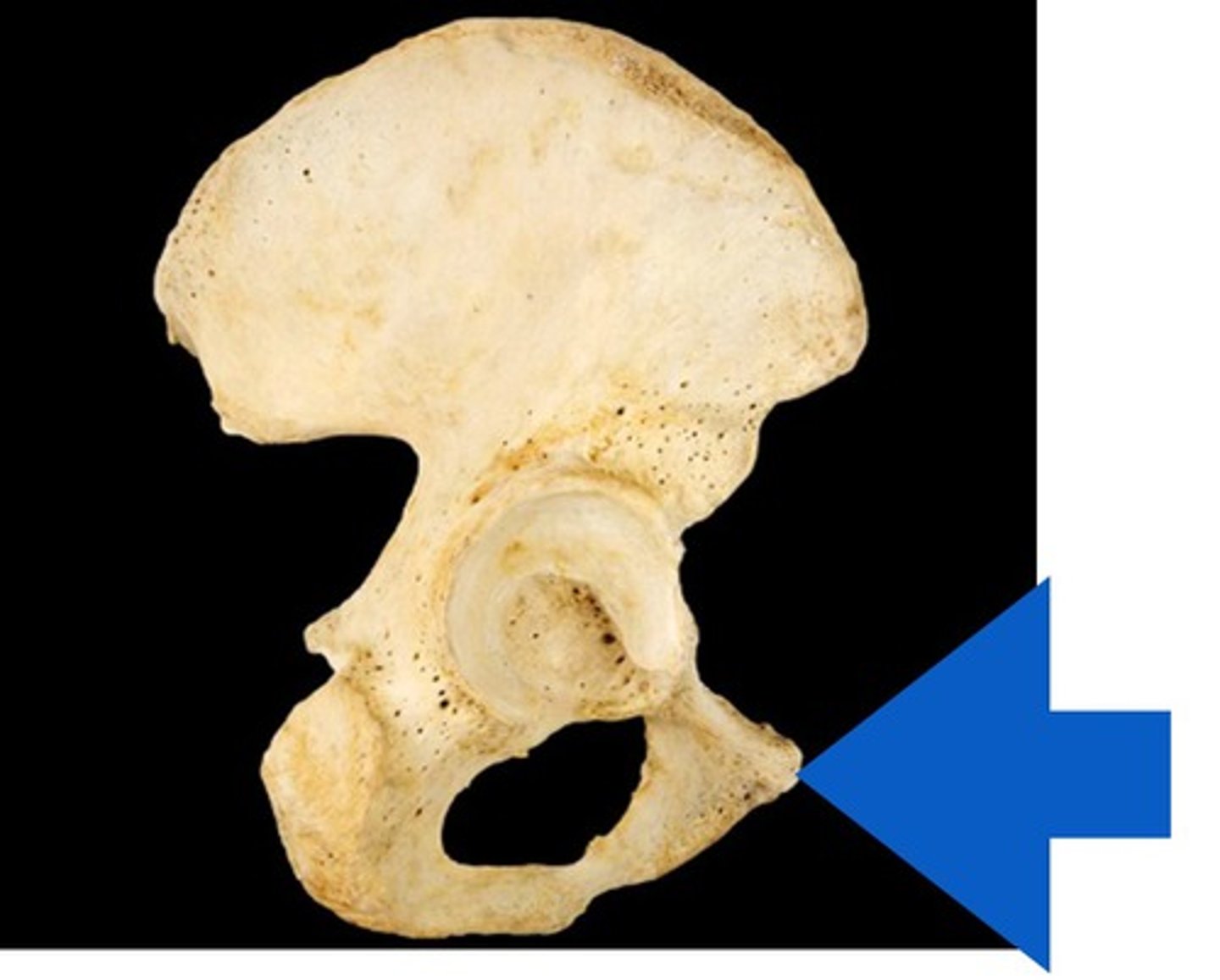 <p>right or left?</p>