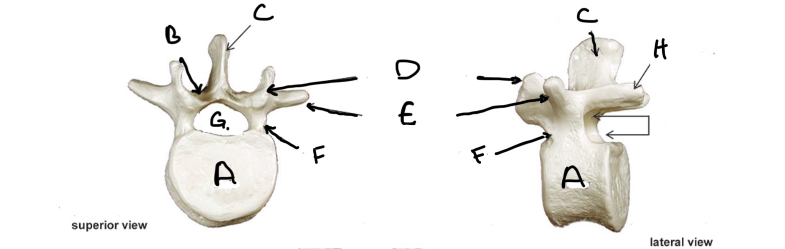 <p>Type of Bone: Lumbar Vertebrae</p><p>What is D?</p>