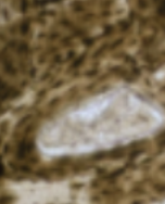<p>Which type of tissue does this image depict?</p>