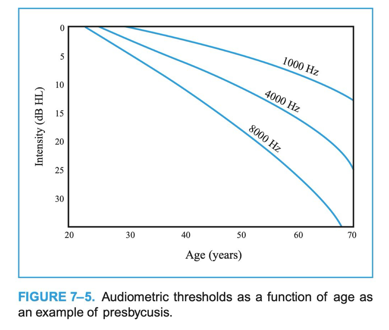 <p>age-related hearing loss; decreases in high-frequency hearing sensitivity (2000-8000 Hz) with age </p>