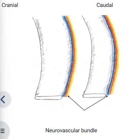<p>When placing a thoracic drain, it must be remembered to insert the drain .. </p>