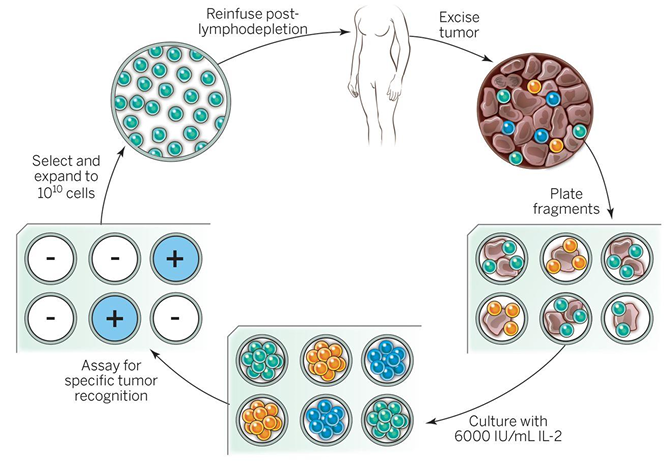 <ul><li><p>Adoptive T cell therapy involves the isolation of tumour-reactive T cells which are expanded in cell culture before transferred back into the patient. This remains an experimental form of therapy. </p></li><li><p>T cells can also be isolated and transduced with a Chimaeric antigen receptor (CAR). CARs have an Ag binding domain derived from an Ab on extracellular side and TCR and costimulatory signalling domains on the intracellularly. CAR-T cells are now approved for the treatment of B cell lymphomas. CAR- T cells for other types of cancers are also under development → novel class of “living drugs”. Effective against B cells as they have unique CD19 and are dispensible - more challenging for other cancers.</p></li></ul><p></p>